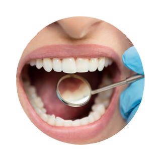 Denizli diş eti tedavisi